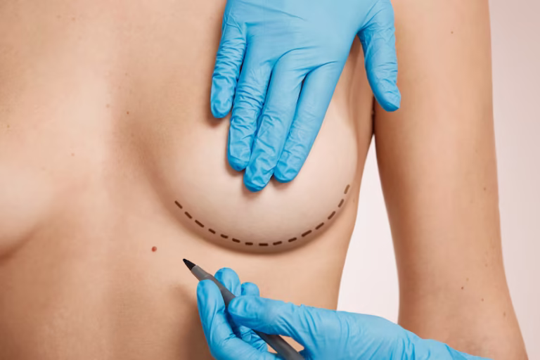 Mamoplastia en Colombia